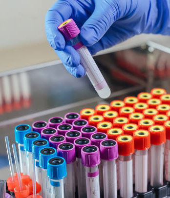 Blood Collection