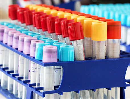 BD Blood Collection Printers from Tammex